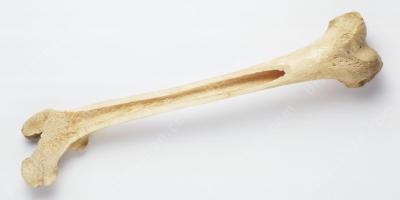 뼈 영화